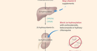 taking-too-much-vitamin-d-can-lead-to-kidney-failure