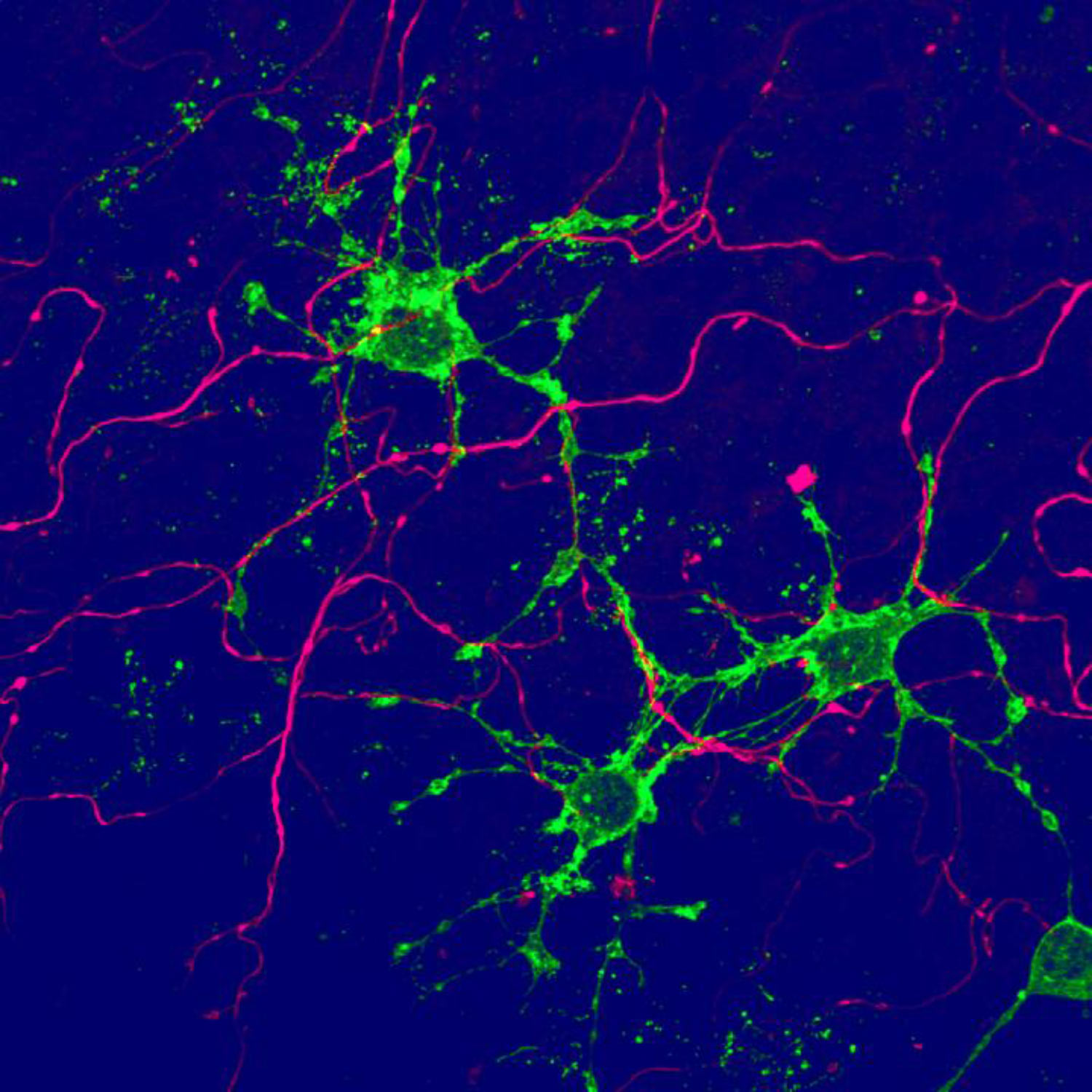 , New Types of Glial Cells, #Bizwhiznetwork.com Innovation &Lambda;Ｉ