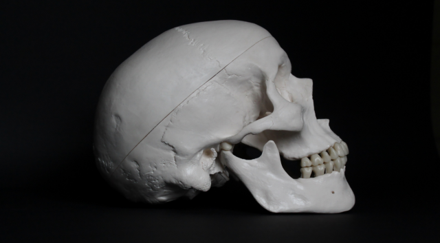 , First Skull Surgery, #Bizwhiznetwork.com Innovation &Lambda;Ｉ